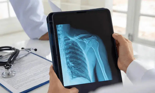 What is a dislocated shoulder? - CLAYER