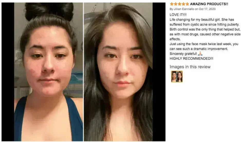 Clay Mask - 4FL.OZ. - Anti-Aging - Ready-to-Use healing clay - Facial Care - CLAYER