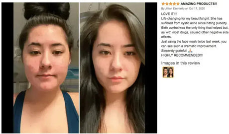 Clay Mask - 4FL.OZ. - Anti-Aging - Ready-to-Use healing clay - Facial Care - CLAYER